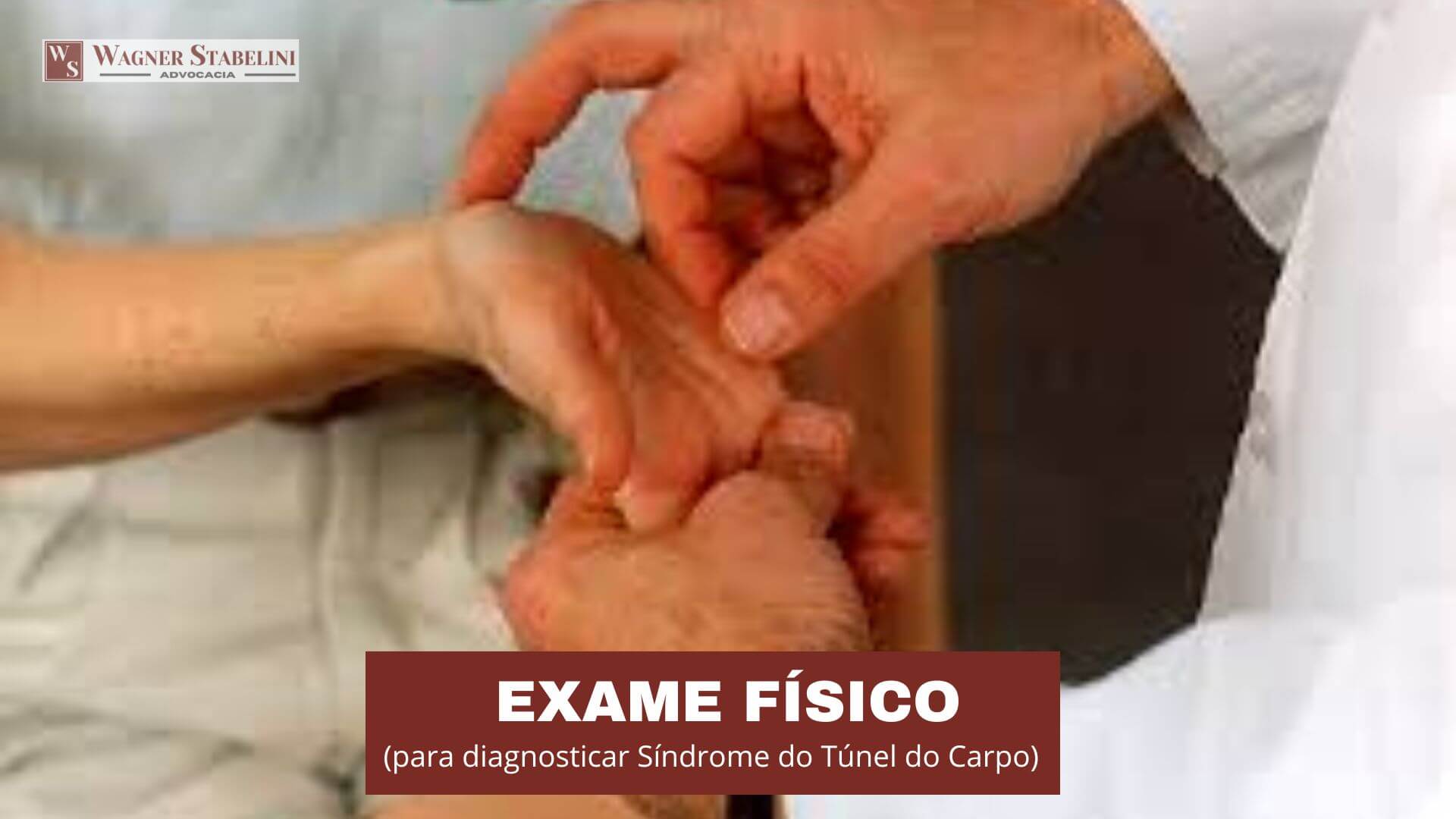 Exame Físico para diagnosticar Síndrome do Túnel do Carpo